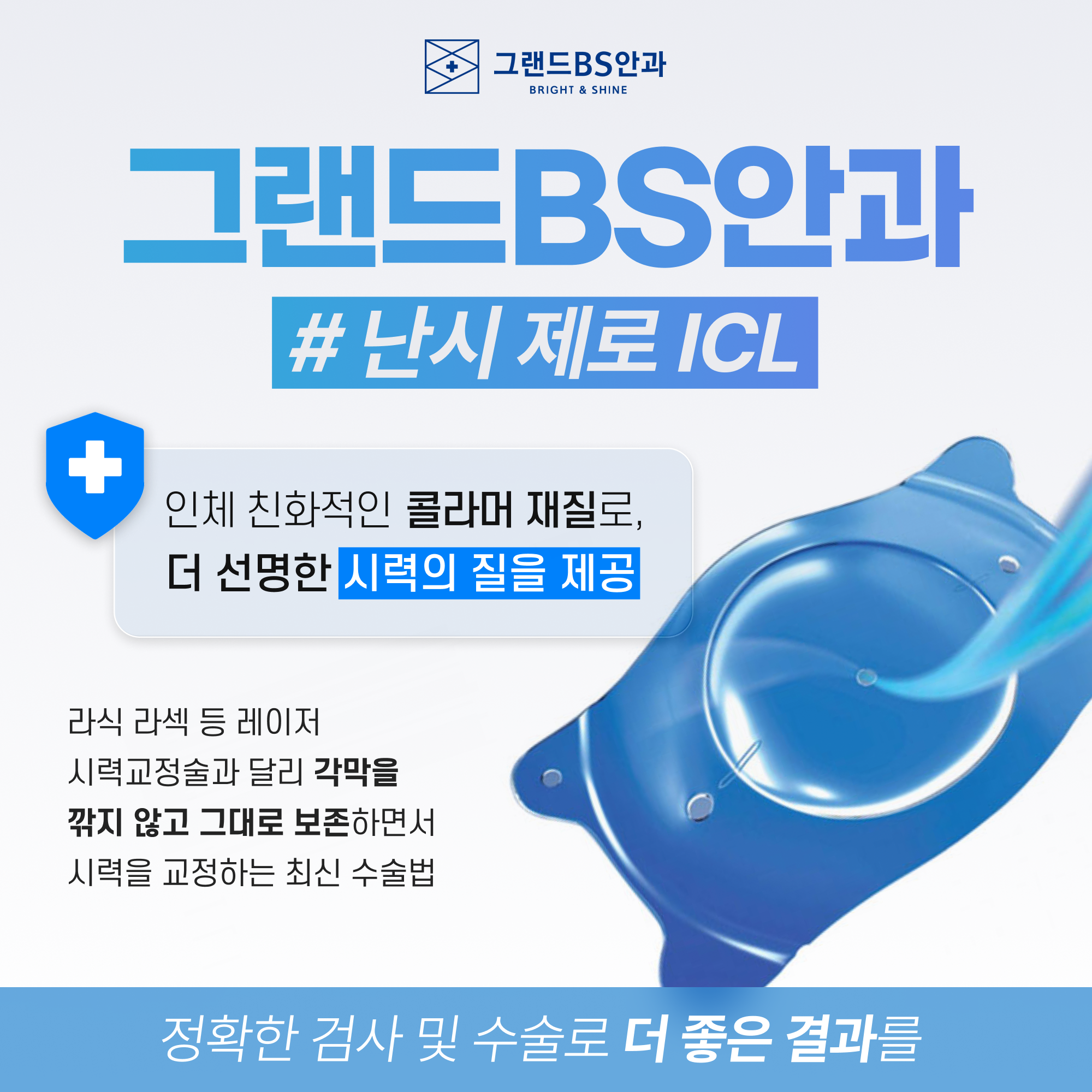 난시 제로 ICL